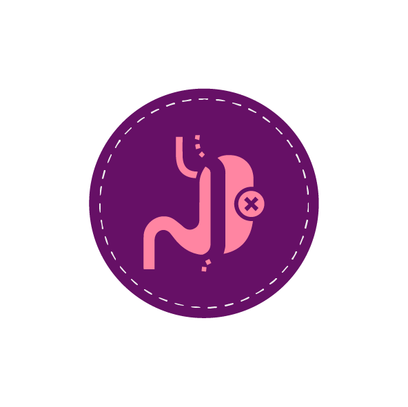 gastric sleev
